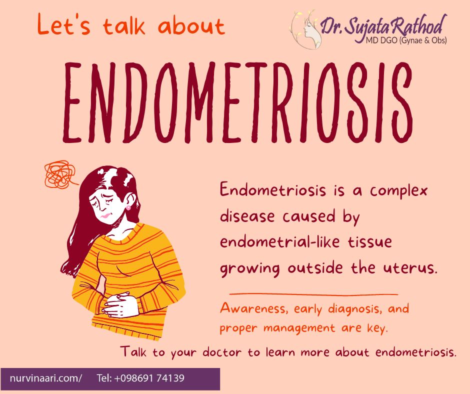 Endometriosis Treatment In Thane-West Bhiwandi