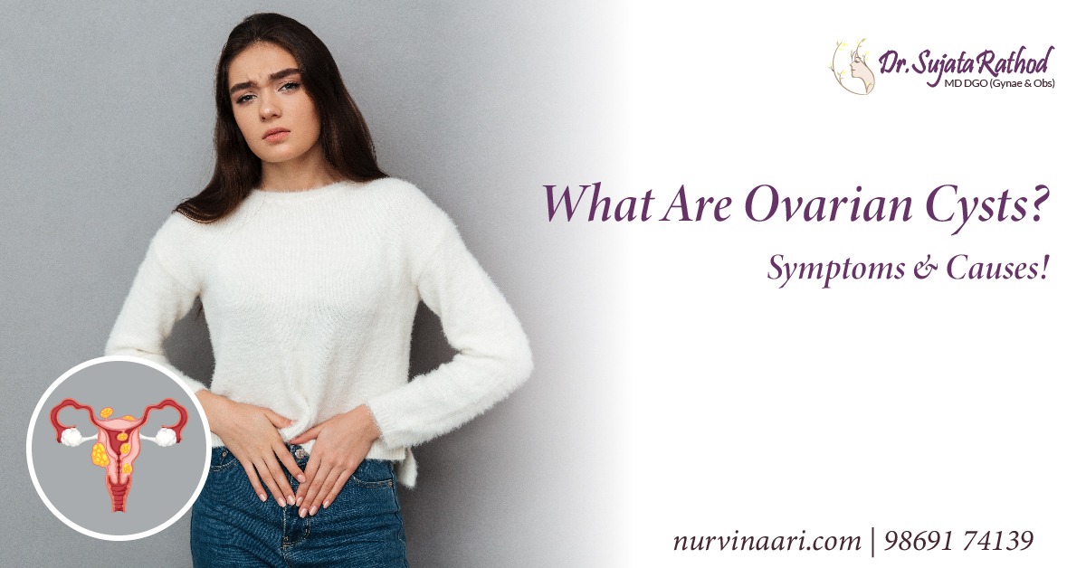 What Are Ovarian Cysts Symptoms And Causes Endometriosis Treatment