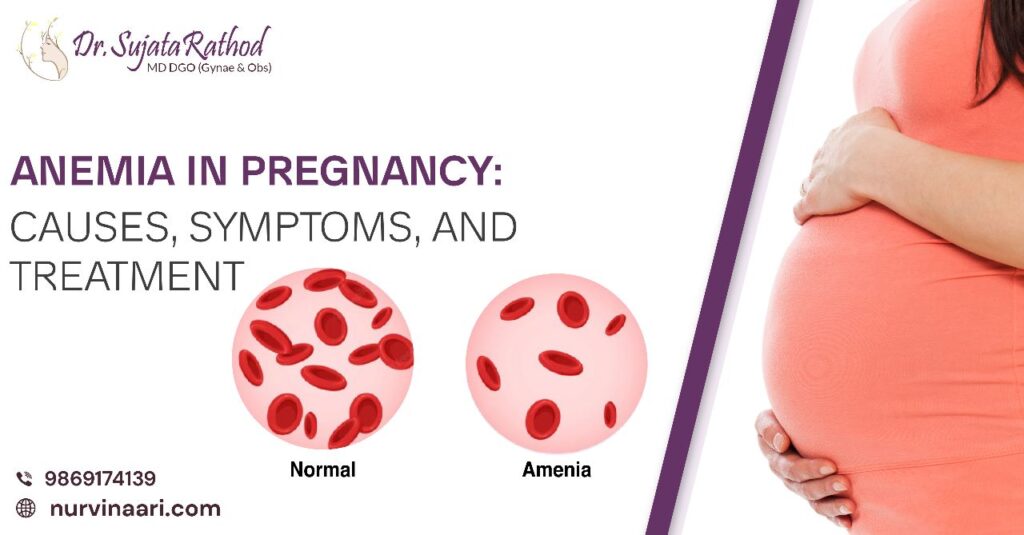 Anemia In Pregnancy Treatment In Thane