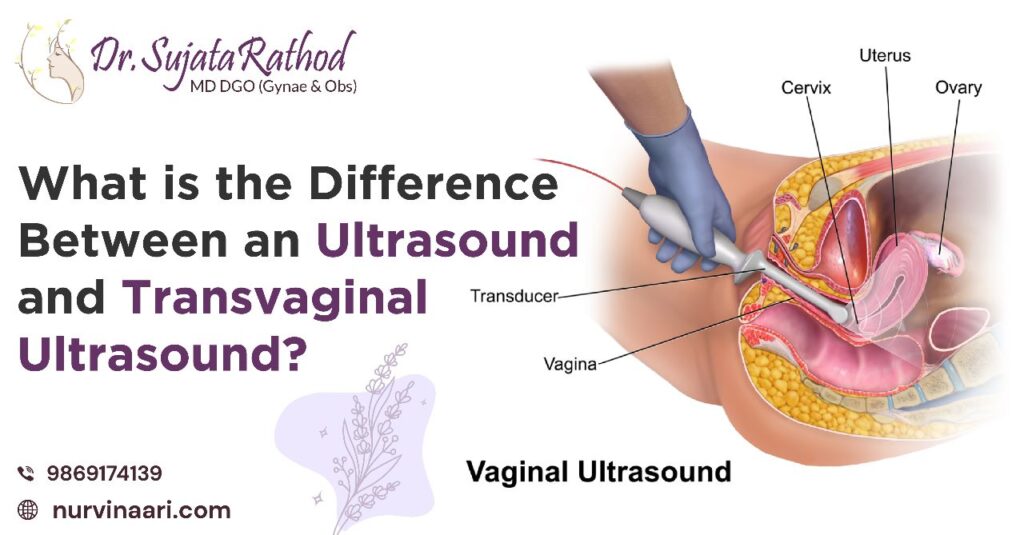 Gynecologist In Thane Ultrasound