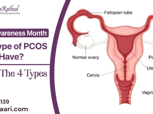 PCOS Awareness Month Sujata Rathod