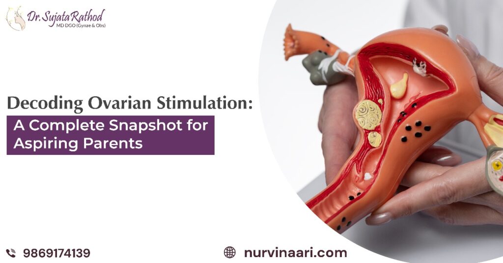 Ovarian Stimulation Dr. Sujata Rathod