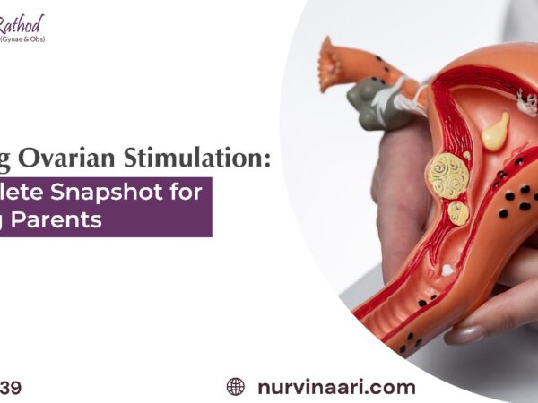 Ovarian Stimulation Dr. Sujata Rathod