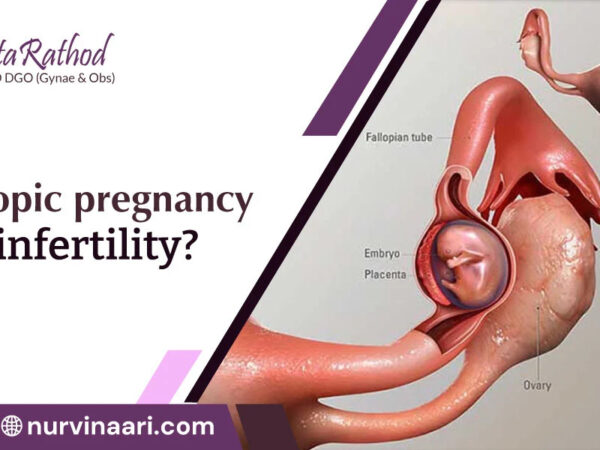 ectopic pregnancy Treatment In Thane