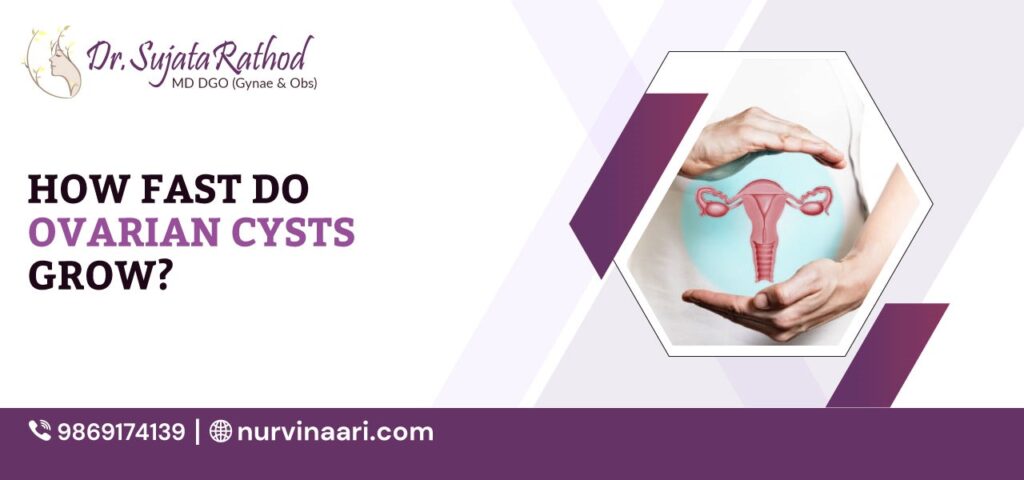 Ovarian-Cysts