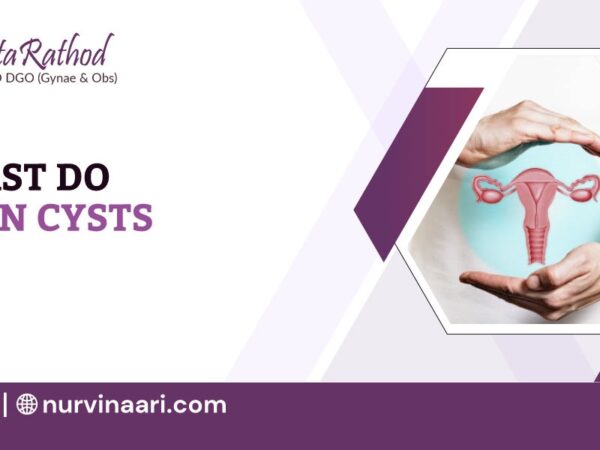 Ovarian-Cysts