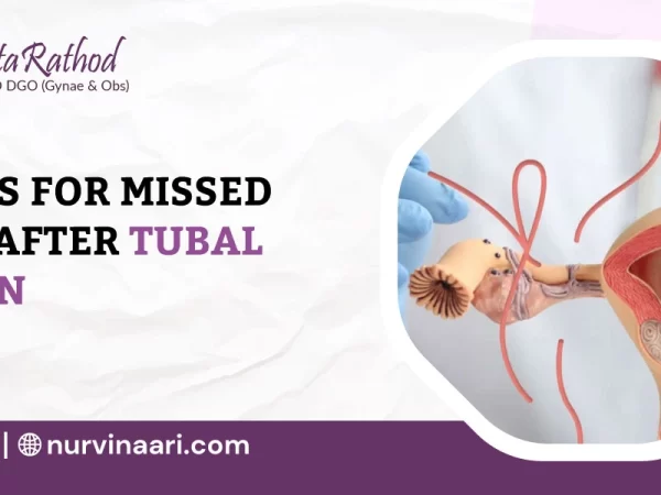 Tubal-Ligation-Treatment-in-Thane