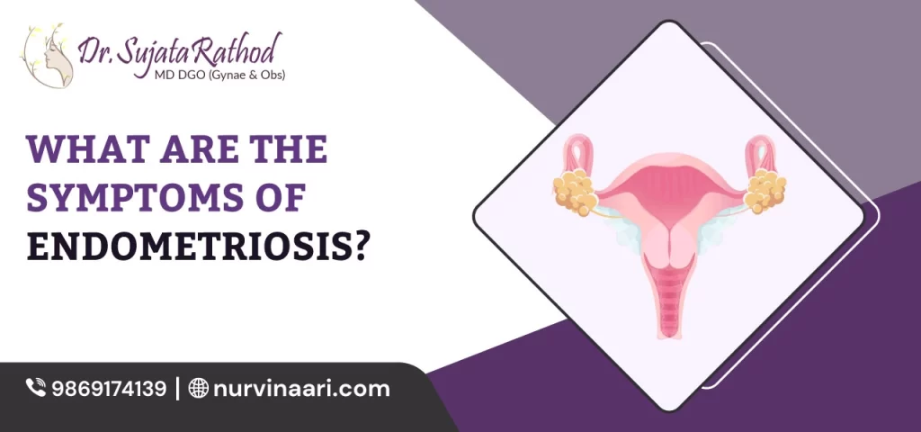 symptoms-of-Endometriosis