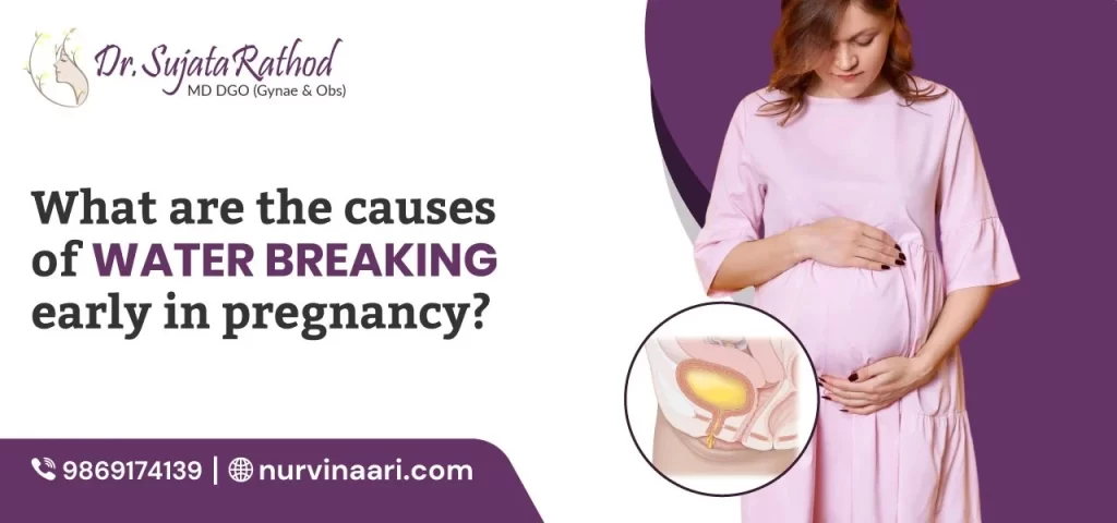 water breaking early in pregnancy
