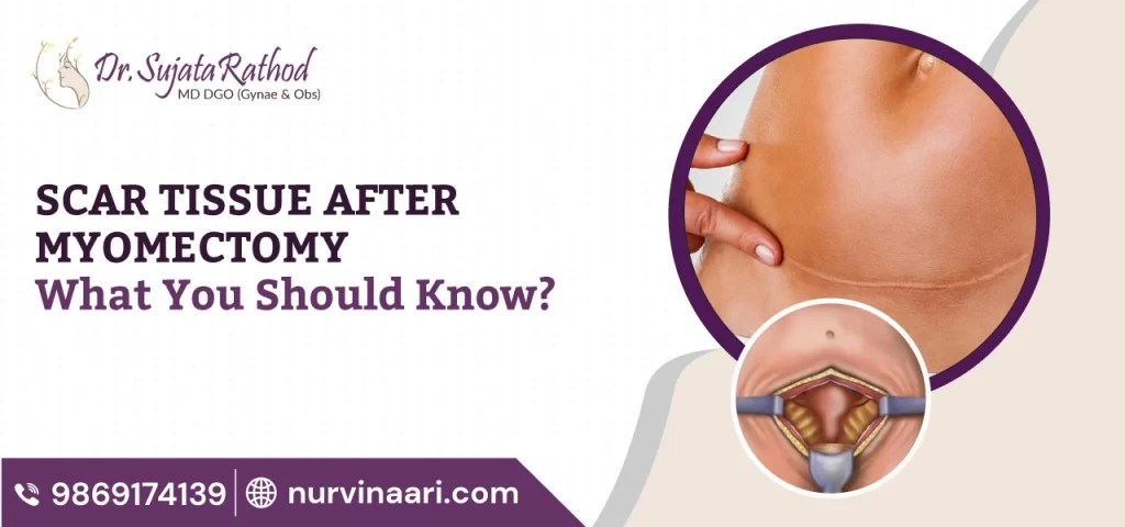 Dr.Sujata-Rathod-Best-Gynecologist-in-Thane