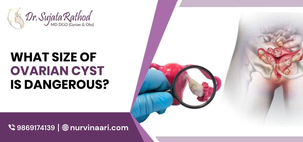 ovarian-cyst-treatment-in-Thane