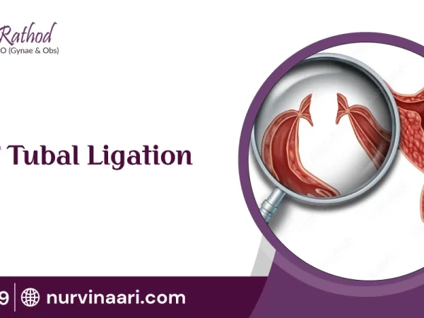 Types-of-Tubal-Ligation