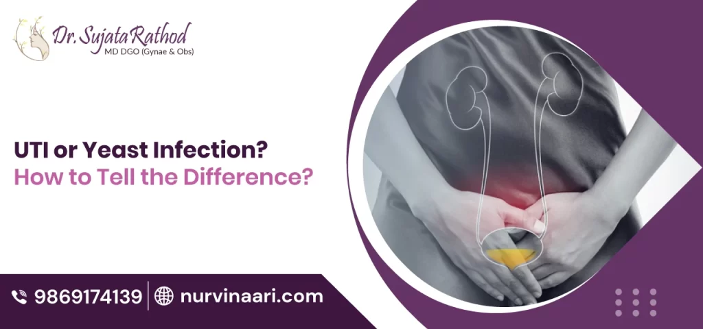 symptoms-of-UTI-or-Yeast-Infection