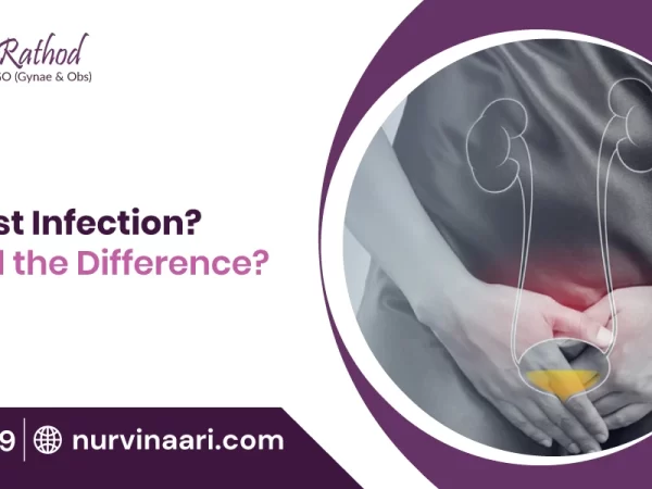 symptoms-of-UTI-or-Yeast-Infection