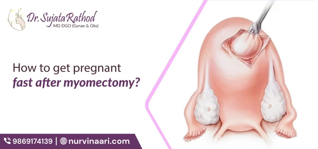 How to Get Pregnant Fast After Myomectomy?