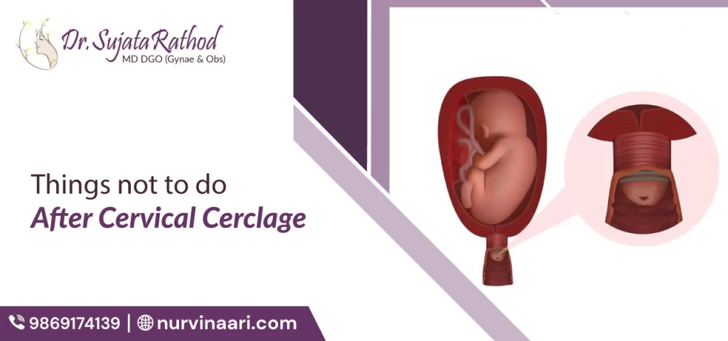 Things Not to Do After Cervical Cerclage
