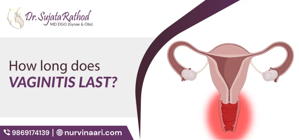How Long Does Vaginitis Last?