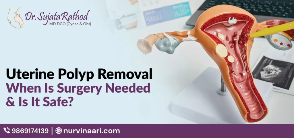 Uterine Polyp Removal: When Is Surgery Needed & Is It Safe?