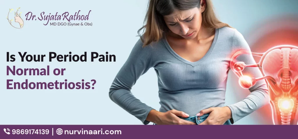 Is Your Period Pain Normal or Endometriosis?