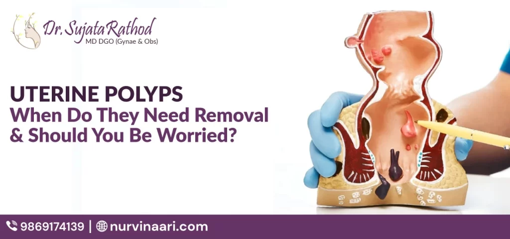 Uterine Polyps: When Do They Need Removal & Should You Be Worried?
