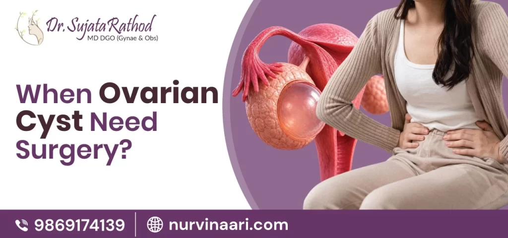 When Ovarian Cyst Need Surgery
