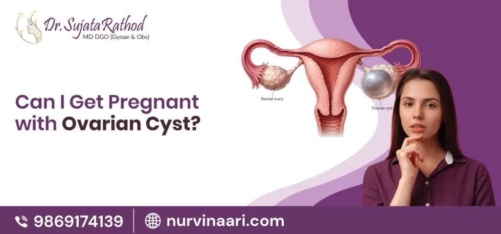 Is Pregnancy Possible with Ovarian Cysts?