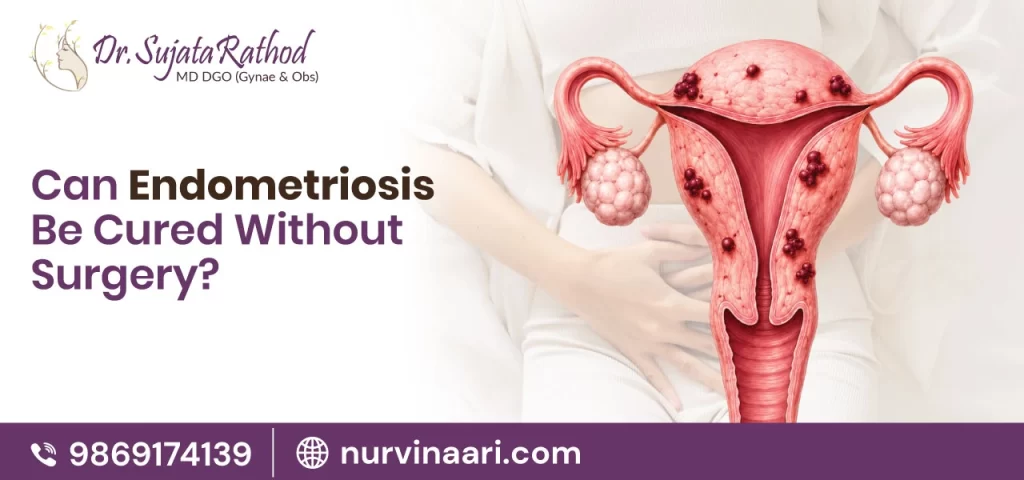 Can Endometriosis Be Cured Without Surgery?